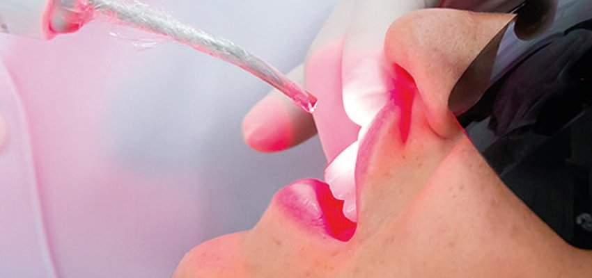 laserterapia laserterapia